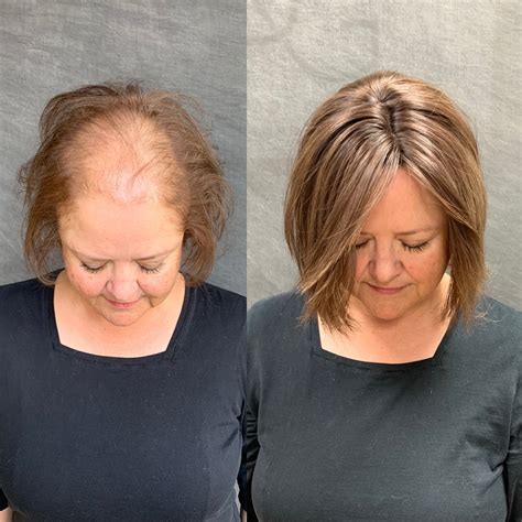 To use this technique, the barber can take one section of hair at a time and pull it away from the body or face. . Hair toppers for thinning crown